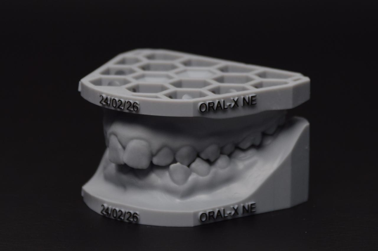 Impressão 3D dental